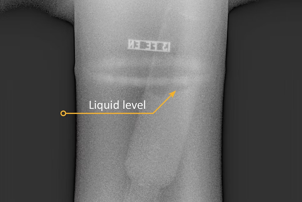4.5” Pipe, 6mmx2 Wall thickness, behind 20cm of water